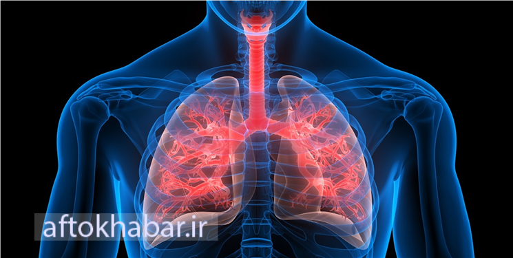 التهاب ریه؛ نگاهی به علائم، عوامل خطرساز و روش‌های درمان